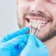 Get a Beautiful Smile Makeover With Miami Dental Implants
