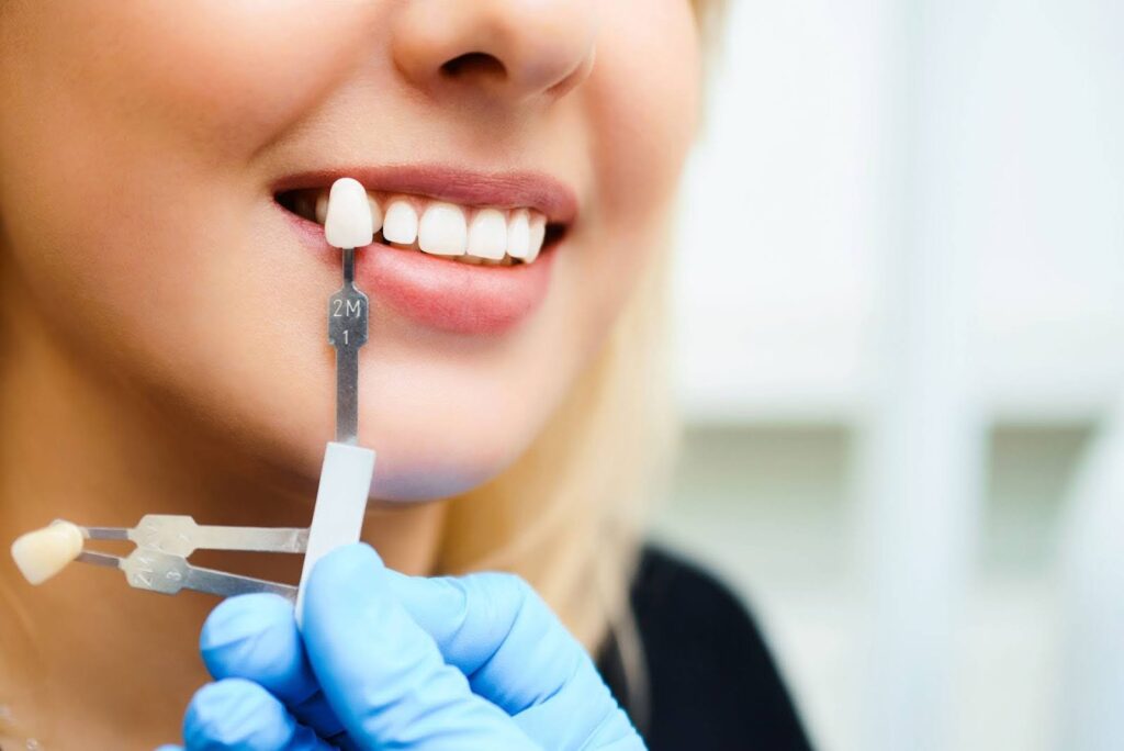 Woman Smiling During Dental Implant Procedure