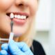 Everything You Need To Know About Dental Implants Miami