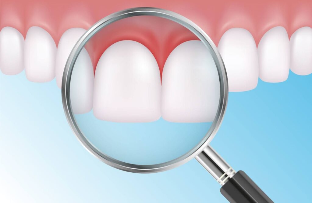 Advanced Methods To Treat Gum Disease In 2024