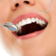 How Much Do Fillings Cost? Are They Affordable Or Not