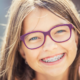 How Much Does It Cost to Fill a Cavity for Teens with Braces?