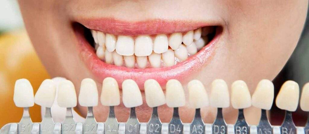 Trends in Dental Filling Costs: New Developments and Changes