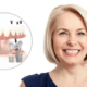 What Makes Affordable Dental Implants the Best Choice for You?