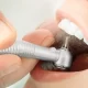 How Frequent Travelers Can Manage Tooth Filling Costs