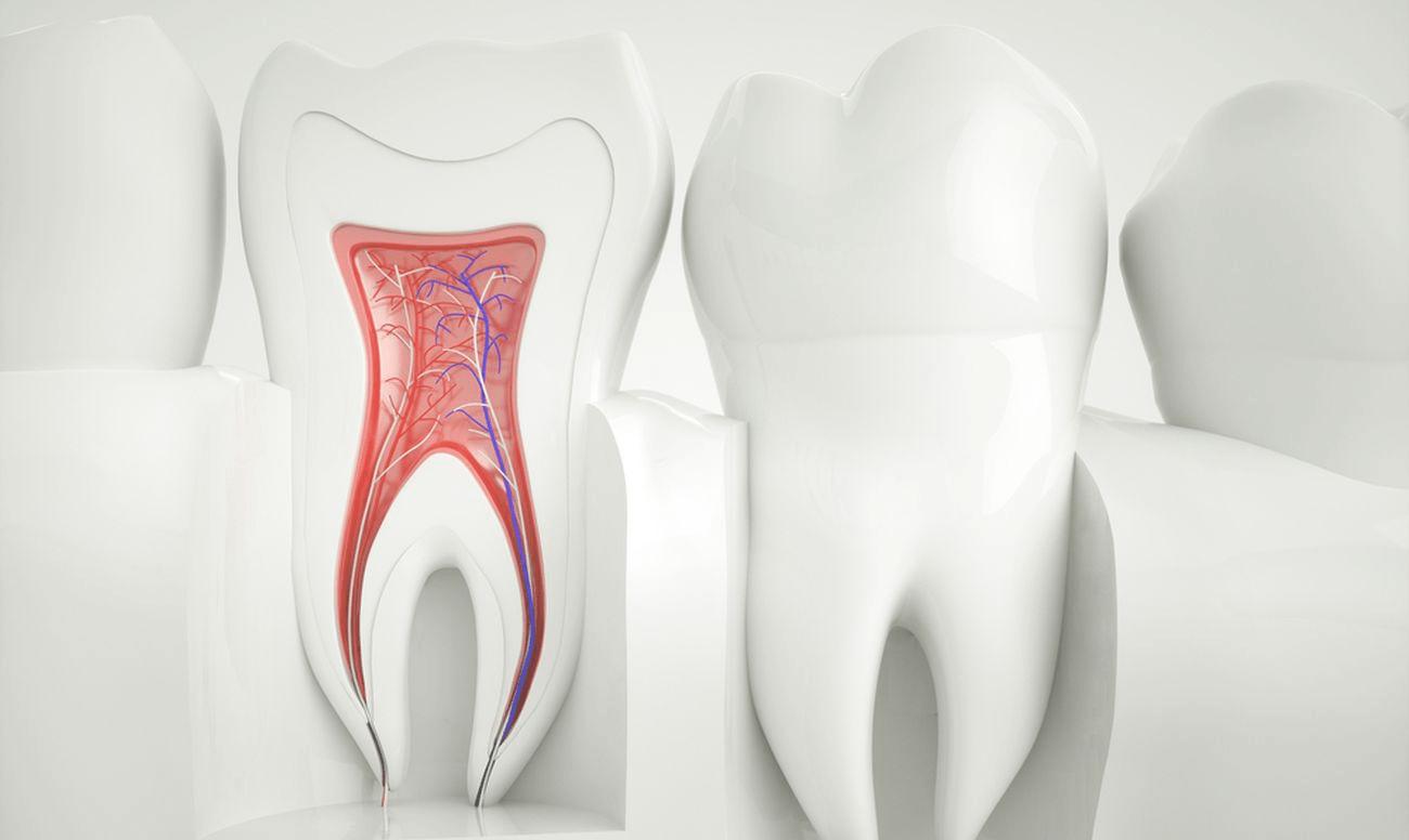  3 Signs You Need a Root Canal 